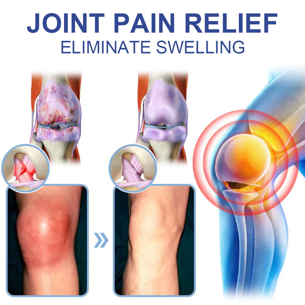 ✨Ourlyard® Magnesium Pain Healing Bone Cream (Treatment for arthritis, neuropathyy, rheumatic diseases, twitches, muscle spasms and sports injuries)